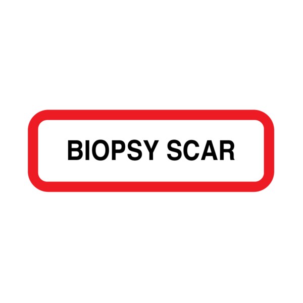 Position Labels - Biopsy Scar 1/2" x 1-1/2" White w/Red & Black